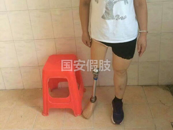 長沙國安假肢康復(fù)用品有限公司,長沙假肢用品,國安假肢康復(fù)用品,假肢矯形器,康復(fù)器材,假肢配件,矯形器支具